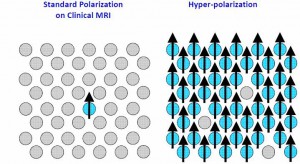 standard_vs_polarized_mri[1]