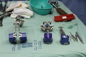 knee replacement equipment1